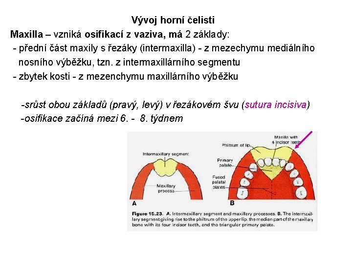 Vývoj horní čelisti Maxilla – vzniká osifikací z vaziva, má 2 základy: - přední