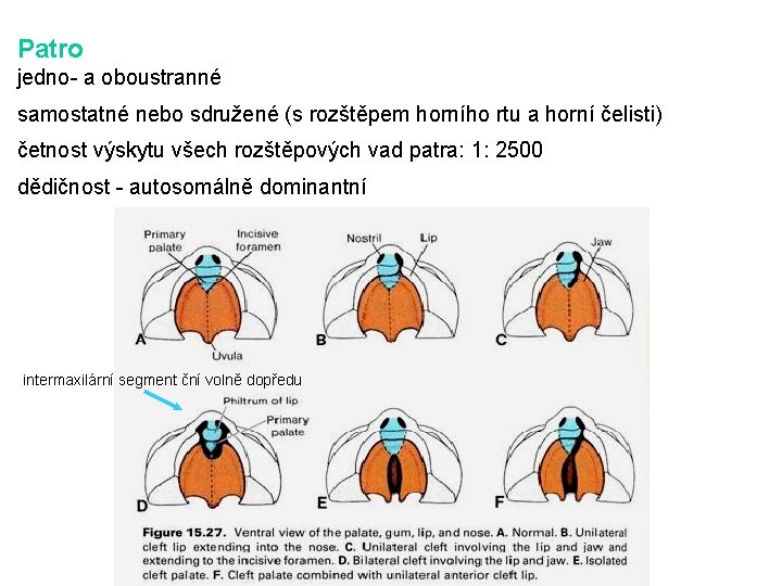 Patro jedno- a oboustranné samostatné nebo sdružené (s rozštěpem horního rtu a horní čelisti)