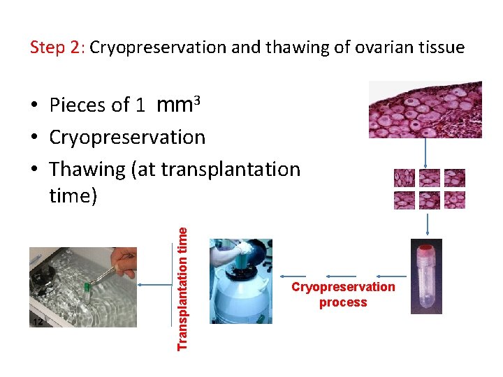 Step 2: Cryopreservation and thawing of ovarian tissue Transplantation time • Pieces of 1