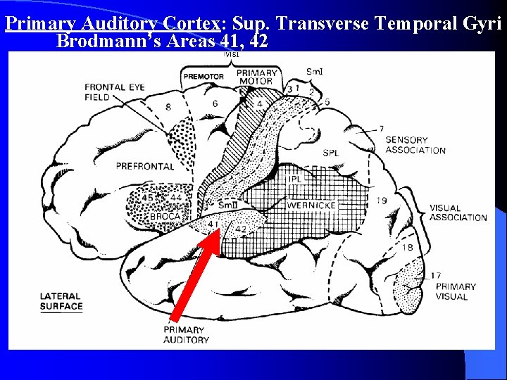 Primary Auditory Cortex: Sup. Transverse Temporal Gyri Brodmann’s Areas 41, 42 