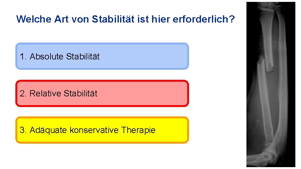 Welche Art von Stabilität ist hier erforderlich? 1. Absolute Stabilität 2. Relative Stabilität 3.