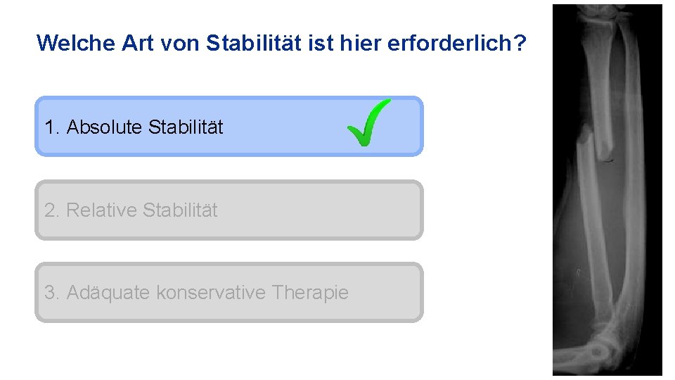 Welche Art von Stabilität ist hier erforderlich? 1. Absolute Stabilität 2. Relative Stabilität 3.