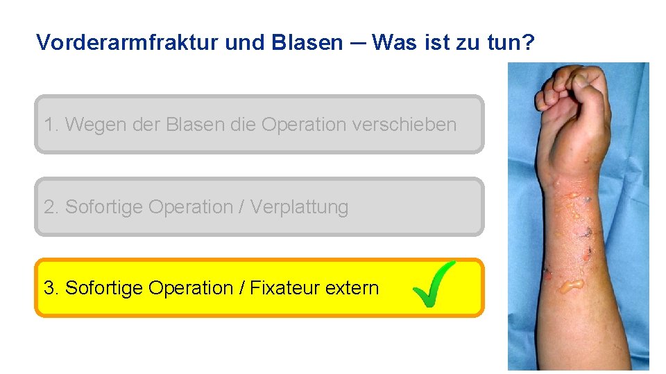 Vorderarmfraktur und Blasen ─ Was ist zu tun? 1. Wegen der Blasen die Operation
