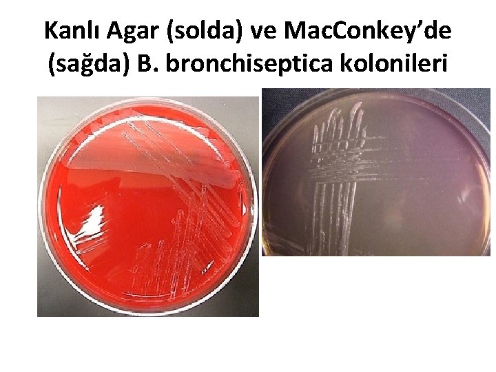 Kanlı Agar (solda) ve Mac. Conkey’de (sağda) B. bronchiseptica kolonileri 