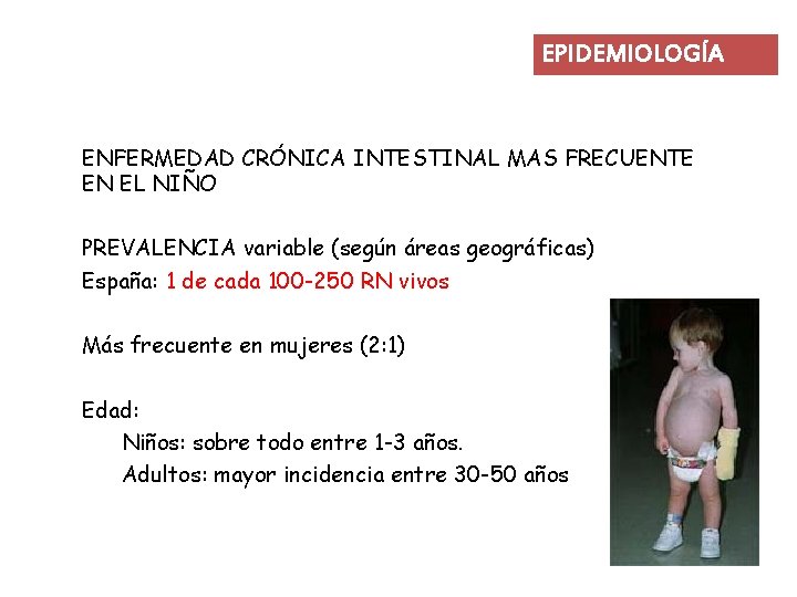 EPIDEMIOLOGÍA ENFERMEDAD CRÓNICA INTESTINAL MAS FRECUENTE EN EL NIÑO PREVALENCIA variable (según áreas geográficas)