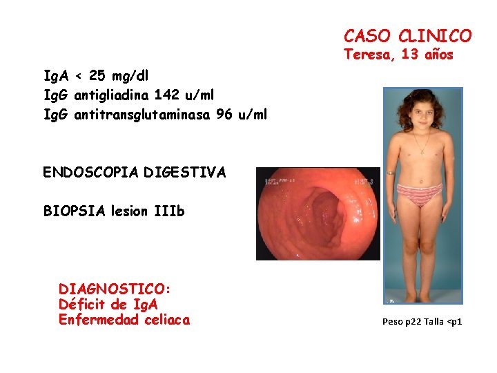 CASO CLINICO Teresa, 13 años Ig. A < 25 mg/dl Ig. G antigliadina 142