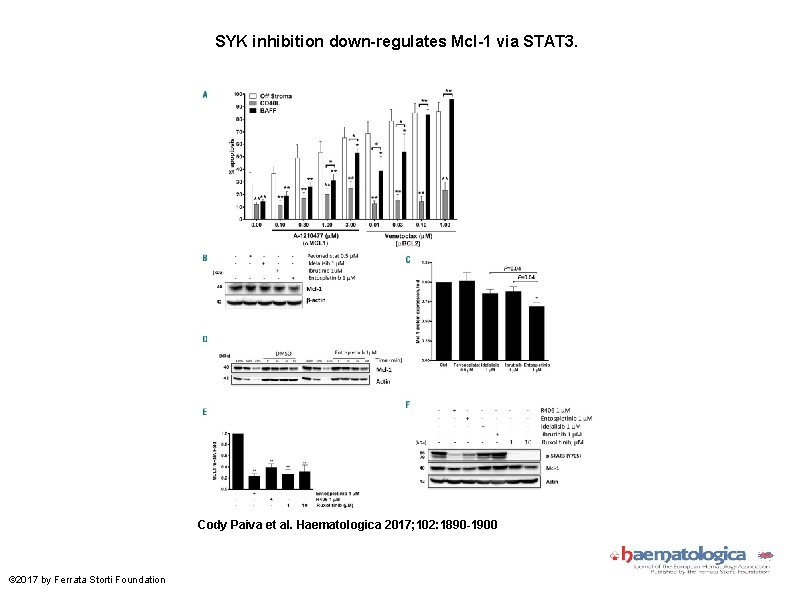 SYK inhibition down-regulates Mcl-1 via STAT 3. Cody Paiva et al. Haematologica 2017; 102: