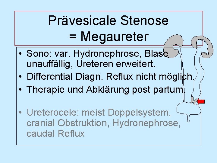 Prävesicale Stenose = Megaureter • Sono: var. Hydronephrose, Blase unauffällig, Ureteren erweitert. • Differential