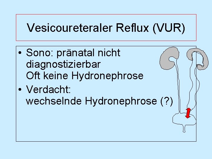 Vesicoureteraler Reflux (VUR) • Sono: pränatal nicht diagnostizierbar Oft keine Hydronephrose • Verdacht: wechselnde