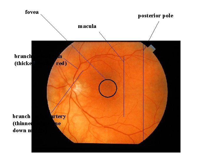 fovea posterior pole macula branch retinal vein (thicker, darker red) branch retinal artery (thinner,
