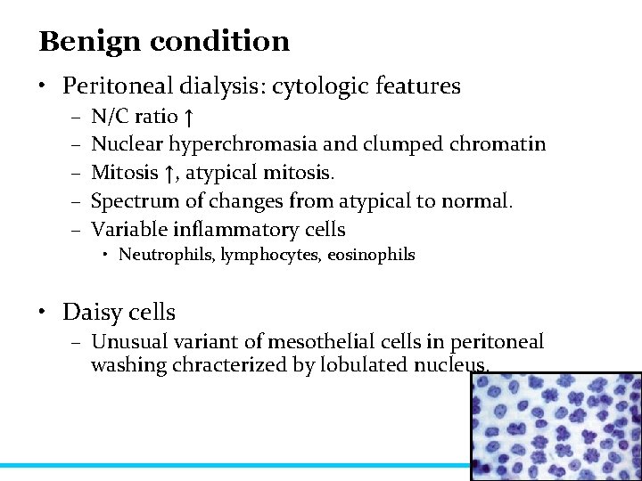Benign condition • Peritoneal dialysis: cytologic features – – – N/C ratio ↑ Nuclear