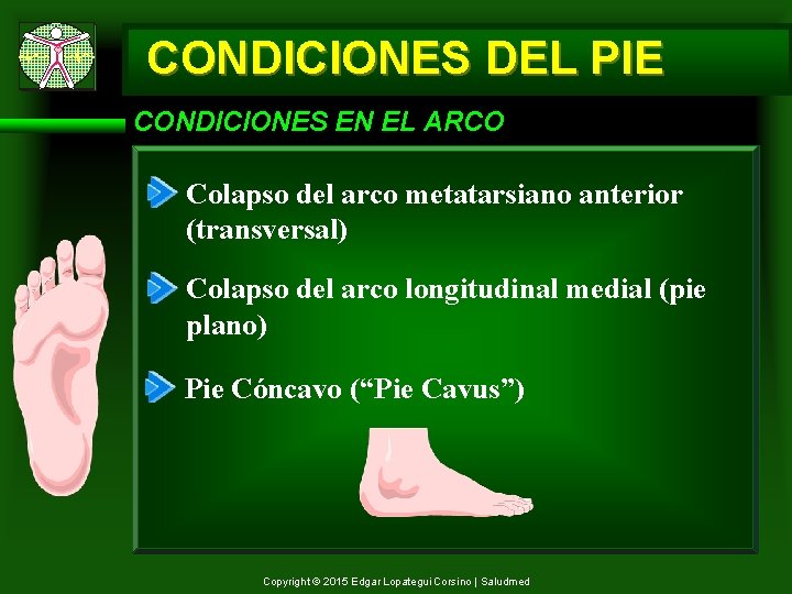 CONDICIONES DEL PIE CONDICIONES EN EL ARCO Colapso del arco metatarsiano anterior (transversal) Colapso