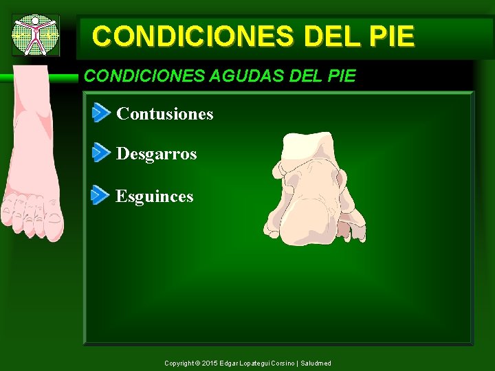 CONDICIONES DEL PIE CONDICIONES AGUDAS DEL PIE Contusiones Desgarros Esguinces Copyright © 2015 Edgar