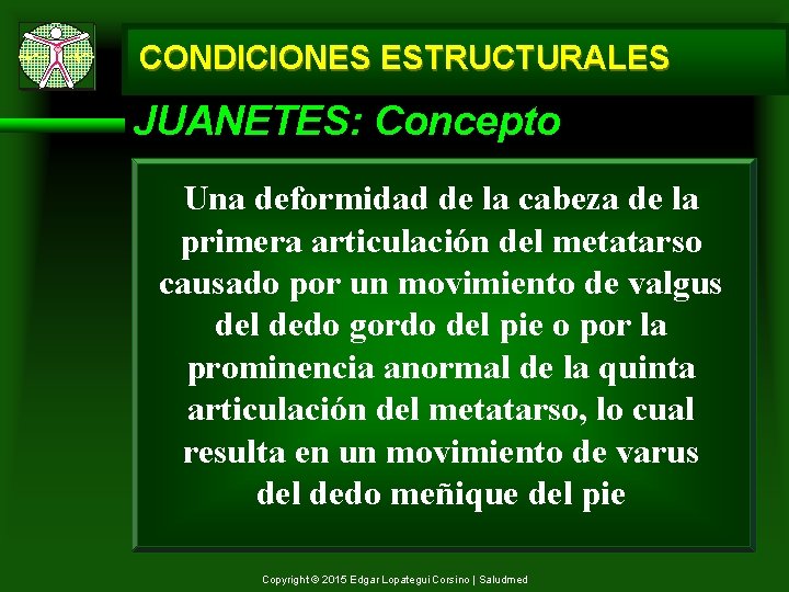 CONDICIONES ESTRUCTURALES JUANETES: Concepto Una deformidad de la cabeza de la primera articulación del