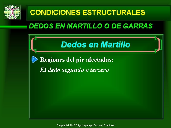 CONDICIONES ESTRUCTURALES DEDOS EN MARTILLO O DE GARRAS Dedos en Martillo Regiones del pie