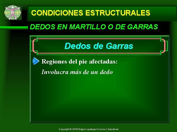 CONDICIONES ESTRUCTURALES DEDOS EN MARTILLO O DE GARRAS Dedos de Garras Regiones del pie