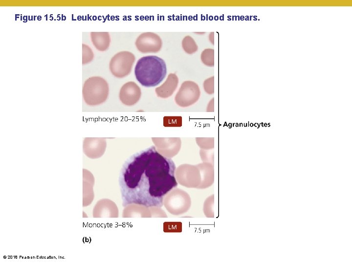 Figure 15. 5 b Leukocytes as seen in stained blood smears. © 2018 Pearson