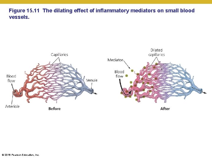 Figure 15. 11 The dilating effect of inflammatory mediators on small blood vessels. ©