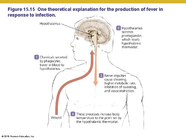Figure 15. 15 One theoretical explanation for the production of fever in response to