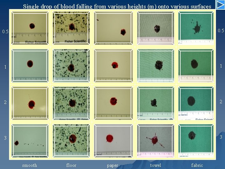 Single drop of blood falling from various heights (m) onto various surfaces 0. 5