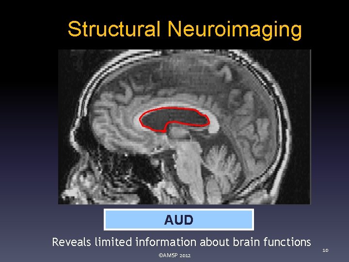 Structural Neuroimaging AUD Reveals limited information about brain functions ©AMSP 2012 10 