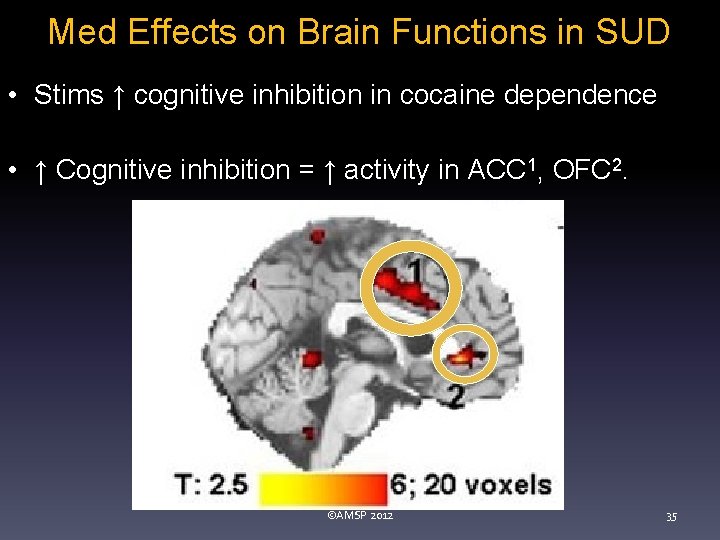 Med Effects on Brain Functions in SUD • Stims ↑ cognitive inhibition in cocaine