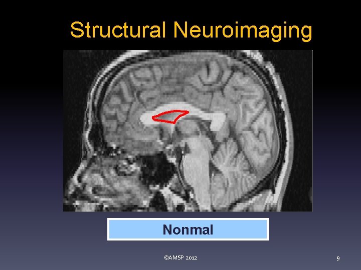 Structural Neuroimaging Nonmal ©AMSP 2012 9 