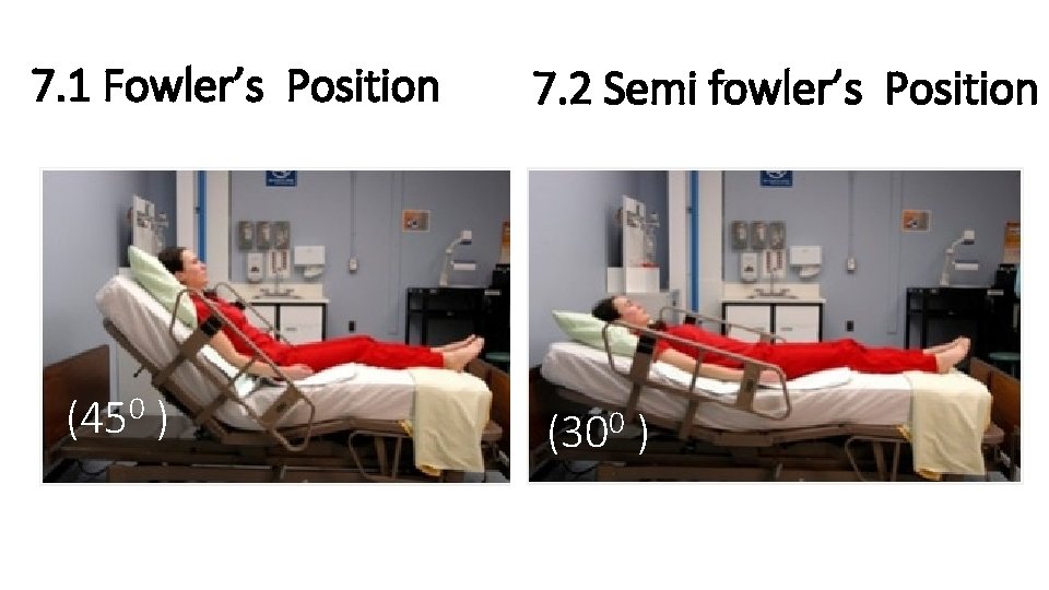 7. 1 Fowler’s Position (450 ) 7. 2 Semi fowler’s Position 0 (30 )