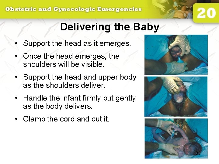 Delivering the Baby • Support the head as it emerges. • Once the head