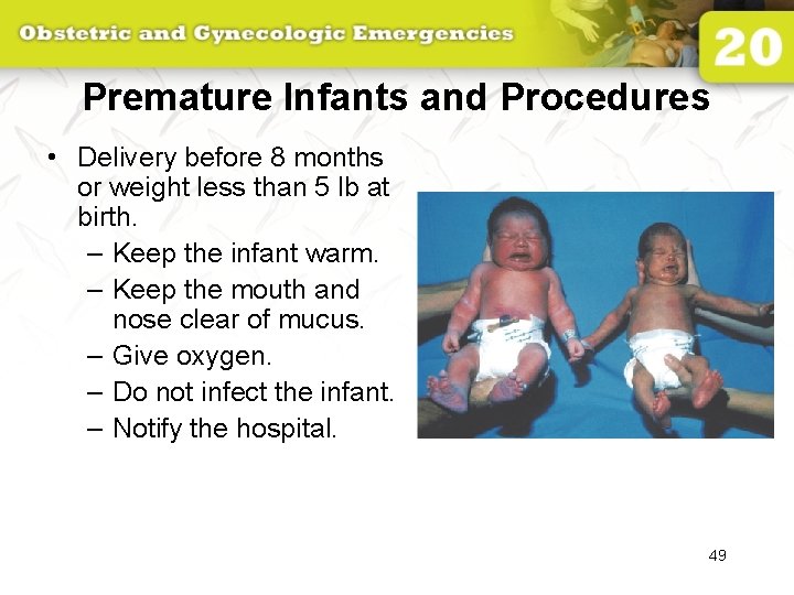 Premature Infants and Procedures • Delivery before 8 months or weight less than 5