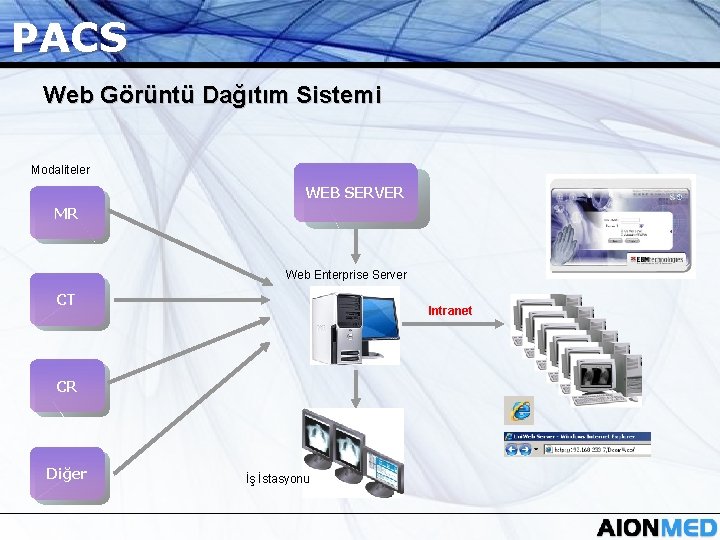 PACS Web Görüntü Dağıtım Sistemi Modaliteler WEB SERVER MR Web Enterprise Server CT Intranet