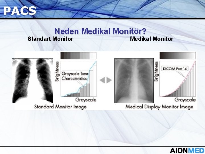 PACS Neden Medikal Monitör? Standart Monitör Medikal Monitör 