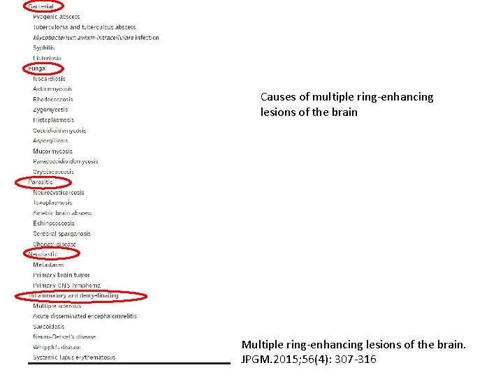 Causes of multiple ring-enhancing lesions of the brain Multiple ring-enhancing lesions of the brain.