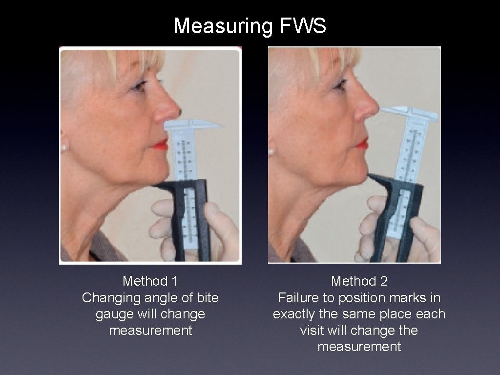 Measuring FWS Method 1 Changing angle of bite gauge will change measurement Method 2