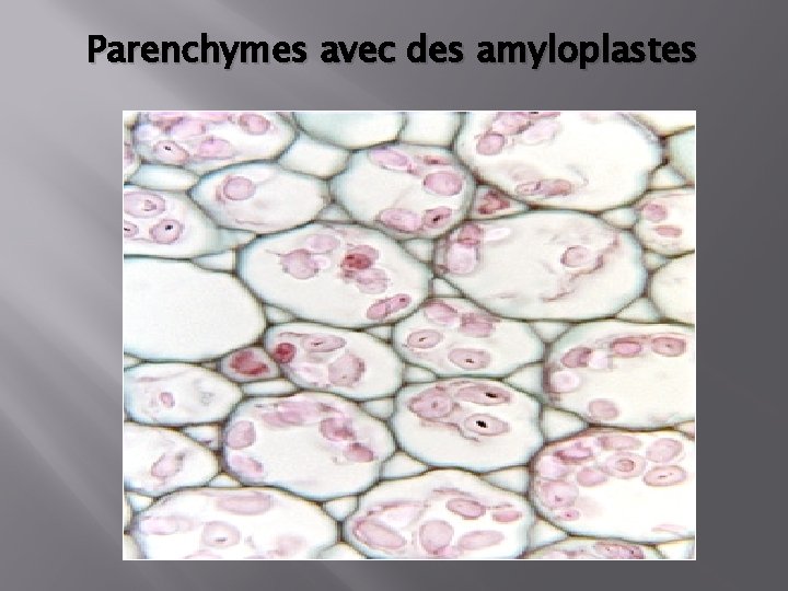 Parenchymes avec des amyloplastes 