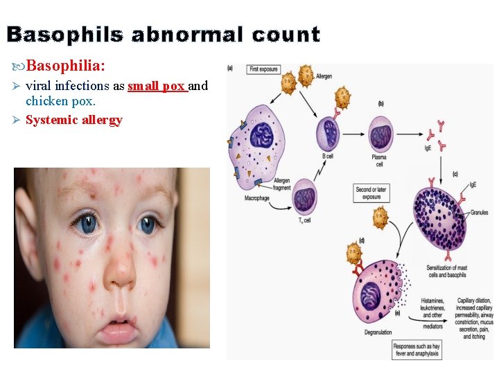 Basophils abnormal count Basophilia: Ø viral infections as small pox and chicken pox. Ø Basophils abnormal count Basophilia: Ø viral infections as small pox and chicken pox. Ø