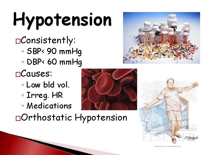 Hypotension �Consistently: ◦ SBP< 90 mm. Hg ◦ DBP< 60 mm. Hg �Causes: ◦