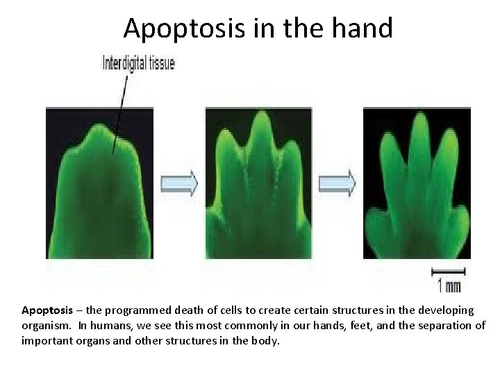 Apoptosis in the hand Apoptosis – the programmed death of cells to create certain