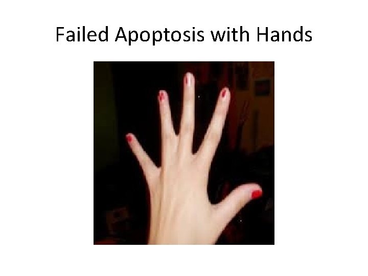 Failed Apoptosis with Hands 