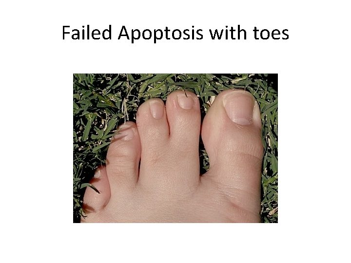 Failed Apoptosis with toes 