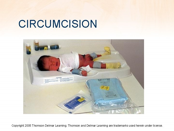 CIRCUMCISION Copyright 2005 Thomson Delmar Learning. Thomson and Delmar Learning are trademarks used herein