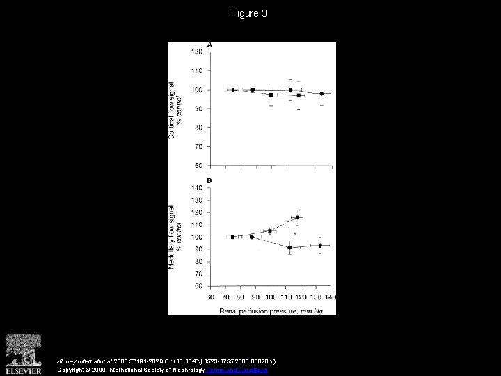 Figure 3 Kidney International 2000 57191 -202 DOI: (10. 1046/j. 1523 -1755. 2000. 00820.