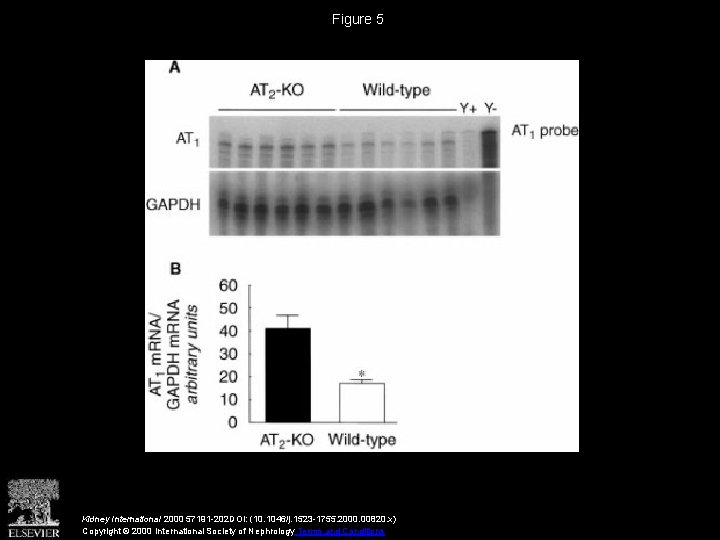 Figure 5 Kidney International 2000 57191 -202 DOI: (10. 1046/j. 1523 -1755. 2000. 00820.