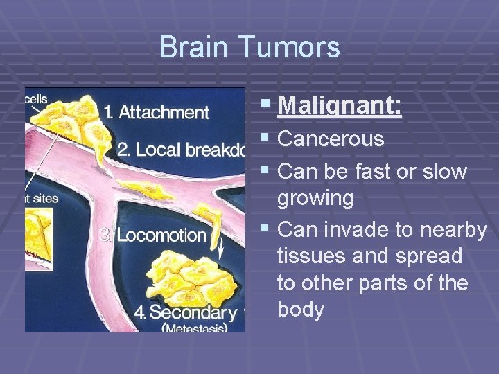 Brain Tumors § Malignant: § Cancerous § Can be fast or slow growing §