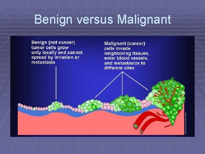 Benign versus Malignant 