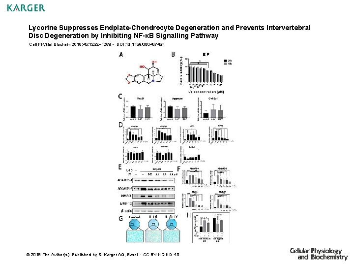 Lycorine Suppresses Endplate-Chondrocyte Degeneration and Prevents Intervertebral Disc Degeneration by Inhibiting NF-κB Signalling Pathway