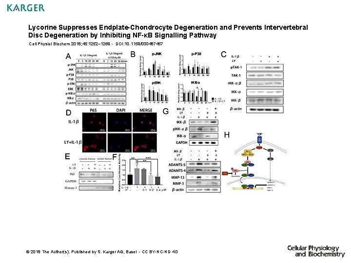 Lycorine Suppresses Endplate-Chondrocyte Degeneration and Prevents Intervertebral Disc Degeneration by Inhibiting NF-κB Signalling Pathway