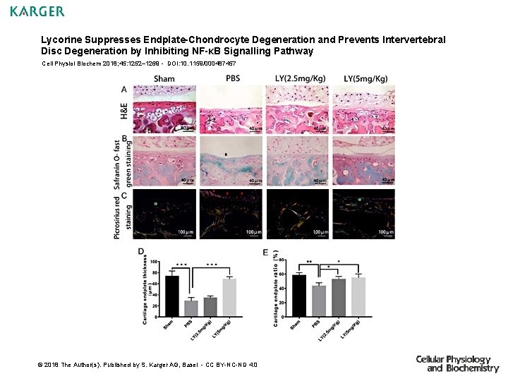 Lycorine Suppresses Endplate-Chondrocyte Degeneration and Prevents Intervertebral Disc Degeneration by Inhibiting NF-κB Signalling Pathway