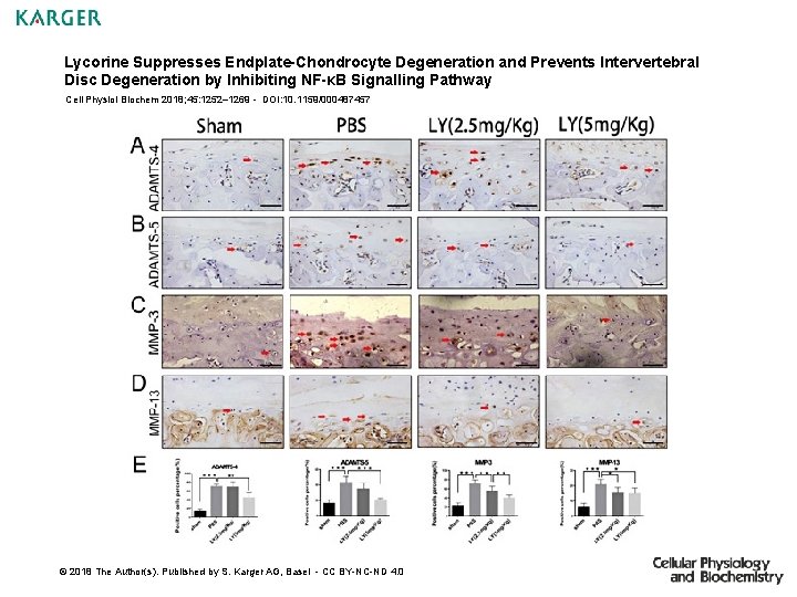 Lycorine Suppresses Endplate-Chondrocyte Degeneration and Prevents Intervertebral Disc Degeneration by Inhibiting NF-κB Signalling Pathway