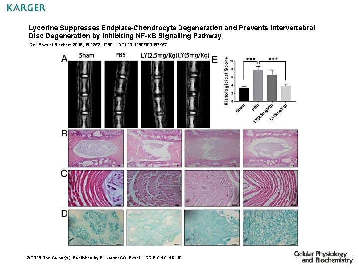 Lycorine Suppresses Endplate-Chondrocyte Degeneration and Prevents Intervertebral Disc Degeneration by Inhibiting NF-κB Signalling Pathway